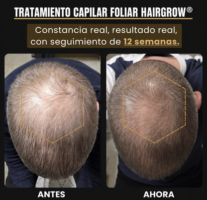 Foliar HairGrowth® - Serum Premium para Crecimiento Capilar